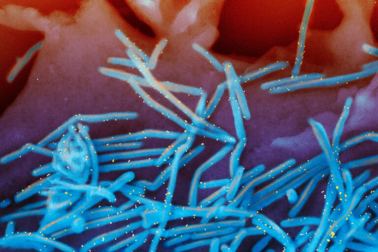 Зимний вирусный сезон пока не так уж плох, но врачи беспокоятся о грядущих страданиях