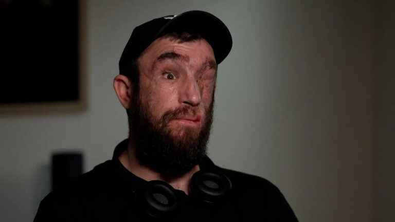 «Сколько еще мы можем дать?» — спрашивает один раненый украинский воин.