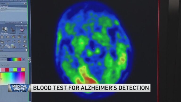 Анализ крови для выявления болезни Альцгеймера — и больше заголовков о здоровье