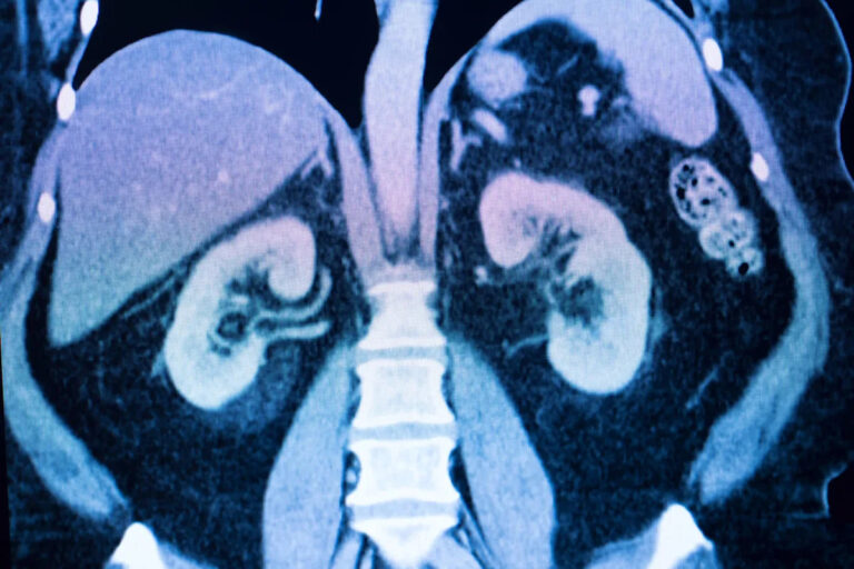 Ученые сделали тревожное открытие о влиянии употребления бутилированной воды на здоровье — вот что вам нужно знать