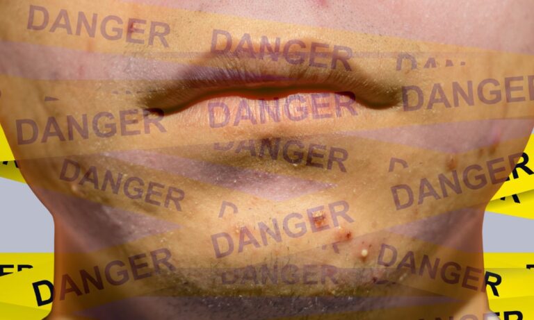 Темная история аккутана: от чистой кожи до залов уголовных судов