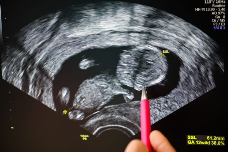 Проверка фактов: Луизиана проголосовала за то, чтобы заставить 9-летнюю жертву изнасилования перенести беременность