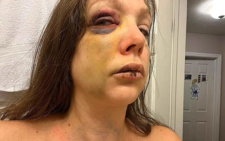 Нападение на женщину на джазовом фестивале «возможно, было расово мотивировано»