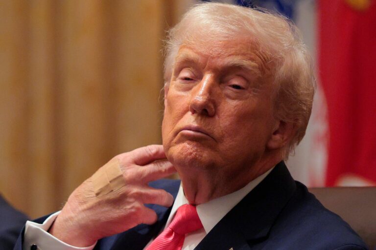 Трамп появляется с пластырем на затылке, когда жалуется на вопросы о своем здоровье